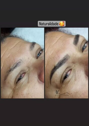 Antes e depois